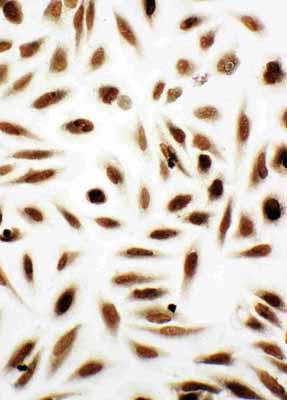 8 - Anti-NME2 Antibody ABO11138