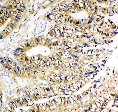 2 - Anti-NME2 Antibody ABO11138