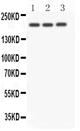 1 - Anti-NOTCH4 Antibody ABO11139