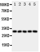 1 - Anti-LOX-1/OLR1 Antibody ABO11140