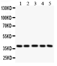 1 - Anti-LOX-1/OLR1 Antibody ABO11141
