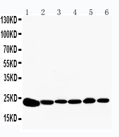 1 - Anti-Peroxiredoxin 2 Antibody ABO11142