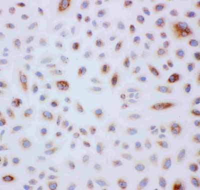 8 - Anti-Peroxiredoxin 3 Antibody ABO11143