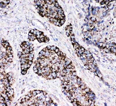 2 - Anti-Peroxiredoxin 3 Antibody ABO11143