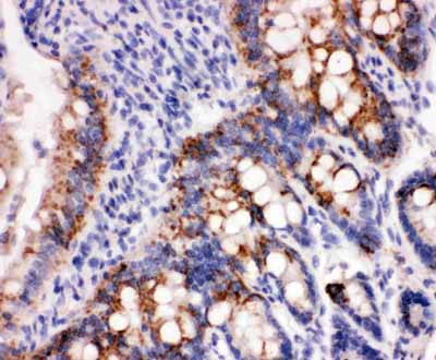2 - Anti-Peroxiredoxin 3 Antibody ABO11143