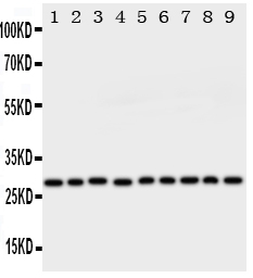 1 - Anti-Peroxiredoxin 3 Antibody ABO11143
