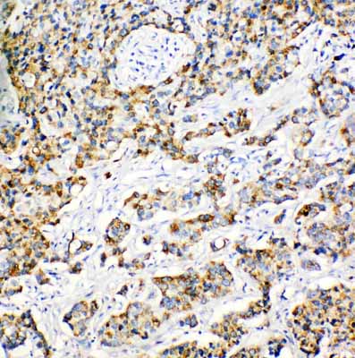2 - Anti-Peroxiredoxin 3 Antibody ABO11144