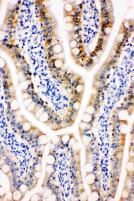 2 - Anti-Peroxiredoxin 3 Antibody ABO11144