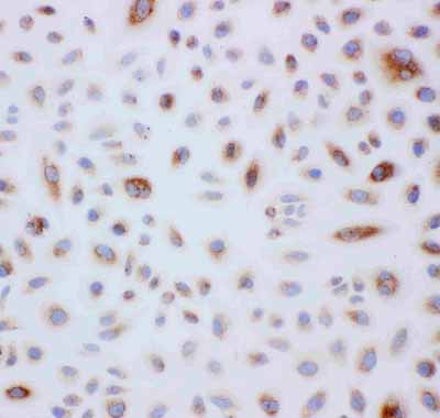 2 - Anti-Peroxiredoxin 3 Antibody ABO11144