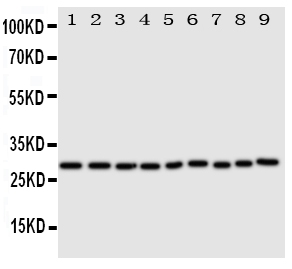 1 - Anti-Peroxiredoxin 3 Antibody ABO11144