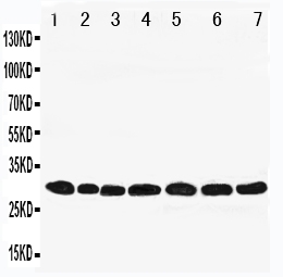1 - Anti-Peroxiredoxin 4 Antibody ABO11145