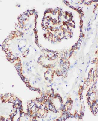 2 - Anti-Peroxiredoxin 5 Antibody ABO11146