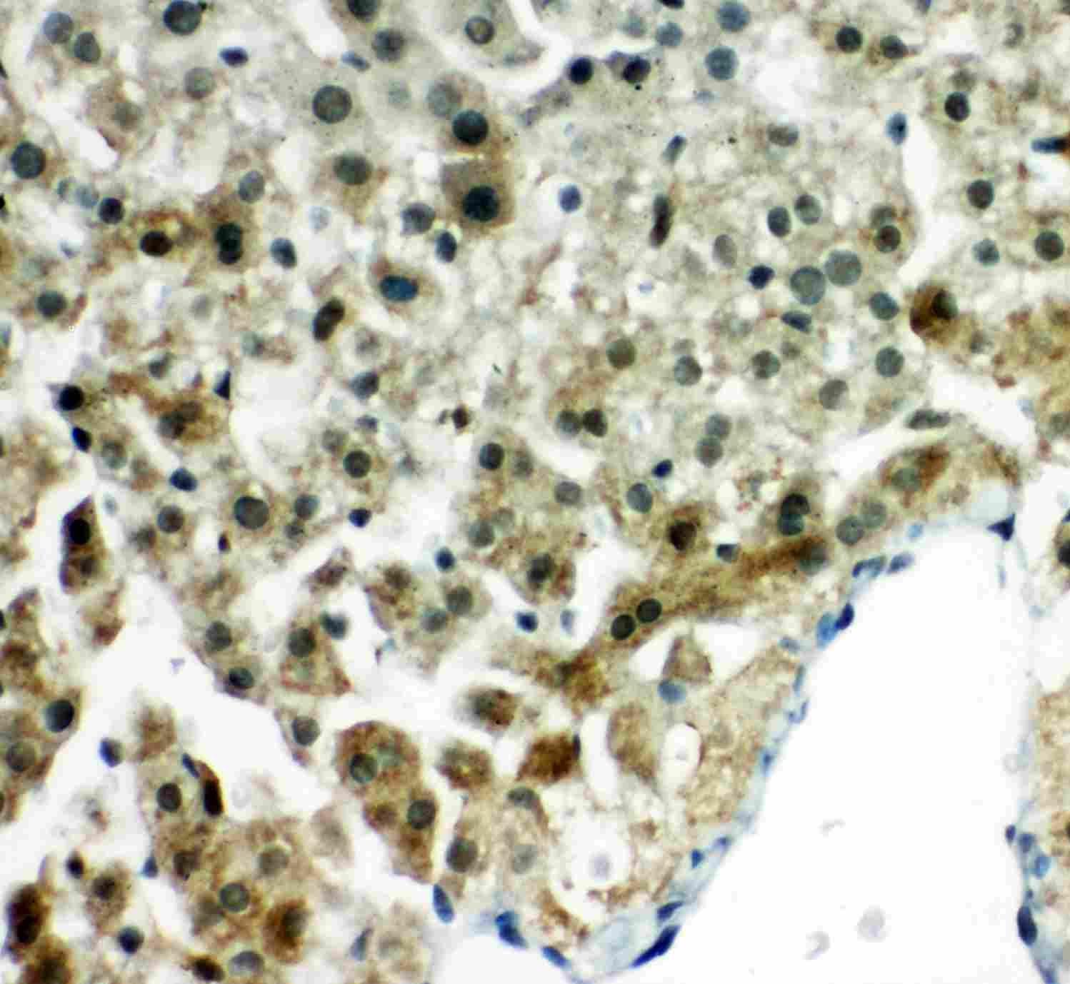 2 - Anti-Peroxiredoxin 5 Antibody ABO11146