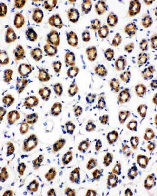 2 - Anti-SDHC Antibody ABO11147