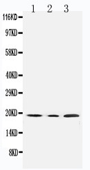 1 - Anti-SDHC Antibody ABO11147