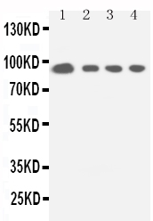 1 - Anti-STAT5a Antibody ABO11148