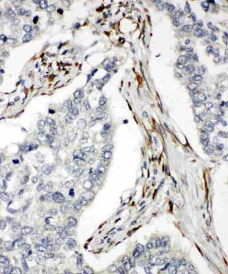 2 - Anti-DR5 Antibody ABO11150