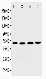 1 - Anti-DR5 Antibody ABO11150