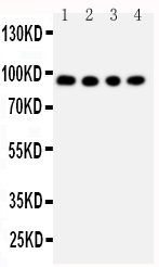 1 - Anti-ADAM17 Antibody ABO11152