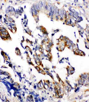 2 - Anti-Beta Arrestin 2 Antibody ABO11153