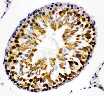 2 - Anti-Beta Arrestin 2 Antibody ABO11153
