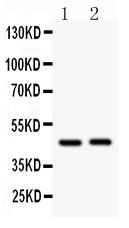 1 - Anti-Beta Arrestin 2 Antibody ABO11153