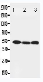 1 - Anti-Beclin 1 Antibody ABO11155