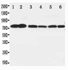 1 - Anti-B Raf Antibody ABO11156