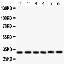 1 - Anti-Caspase 3 Antibody ABO11157