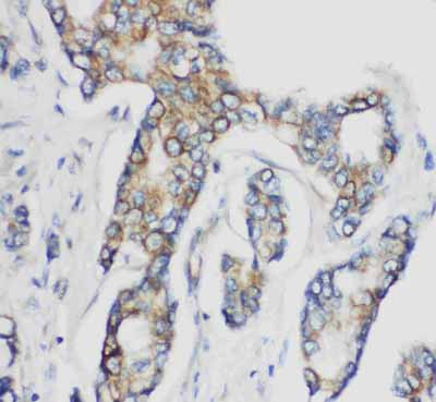 2 - Anti-CD1d Antibody ABO11158