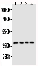 1 - Anti-CD1d Antibody ABO11158