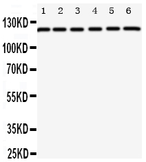 1 - Anti-Coxsackie Adenovirus Receptor Antibody ABO11160