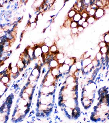 2 - Anti-Fatty Acid Binding Protein 5 Antibody ABO11161