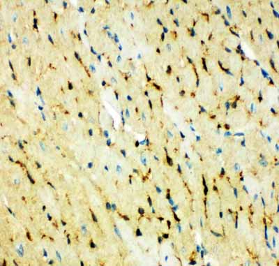 2 - Anti-Fatty Acid Binding Protein 5 Antibody ABO11161
