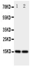 1 - Anti-Fatty Acid Binding Protein 5 Antibody ABO11161
