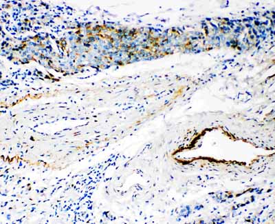 2 - Anti-HYAL3 Antibody ABO11165