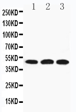 1 - Anti-HYAL3 Antibody ABO11165