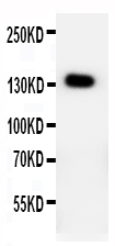 1 - Anti-PTCH2 Antibody ABO11167