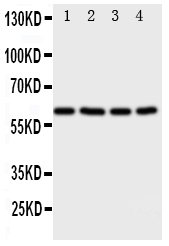 1 - Anti-RIP2 Antibody ABO11169