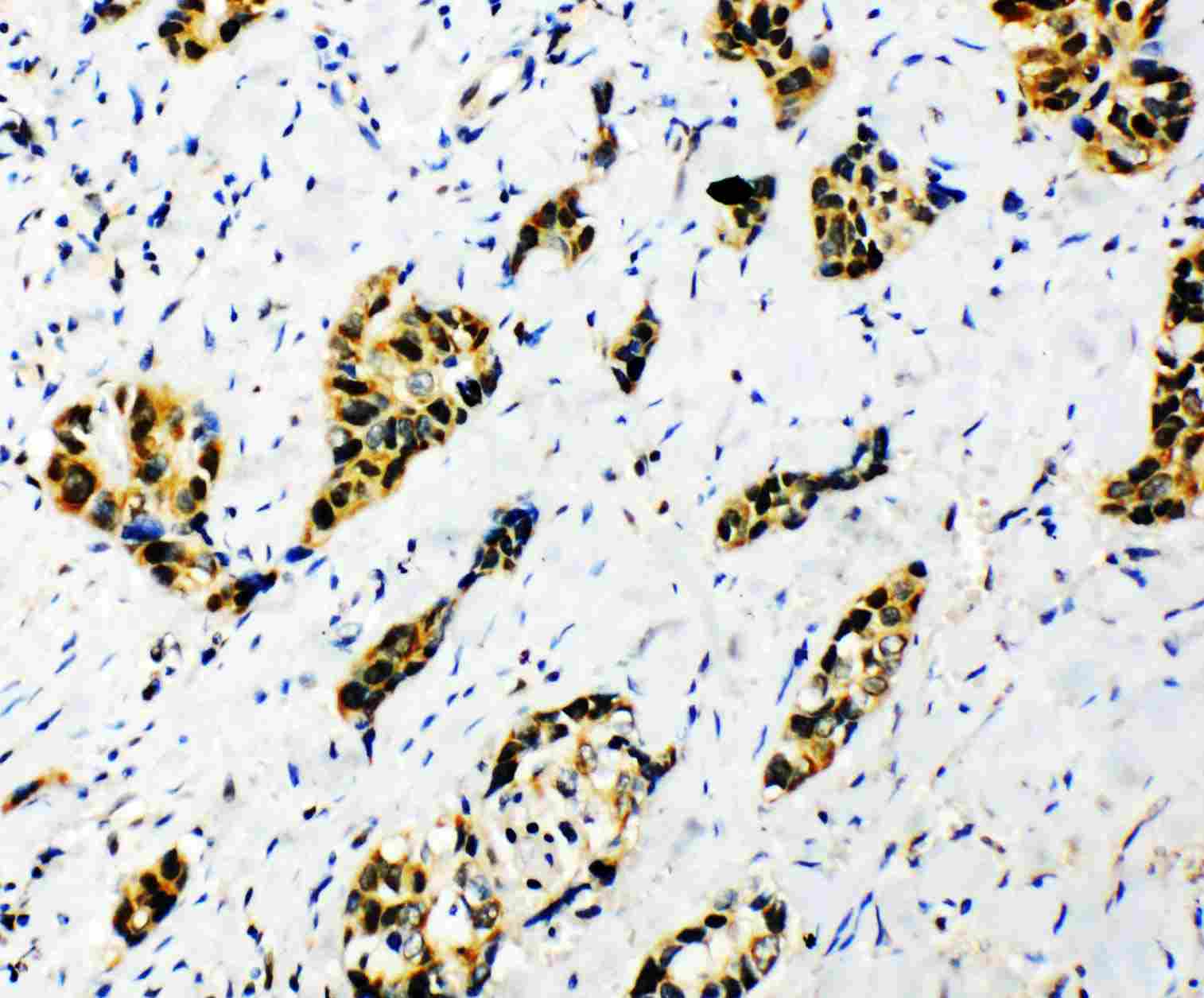 2 - Anti-splicing Factor 1 Antibody ABO11171
