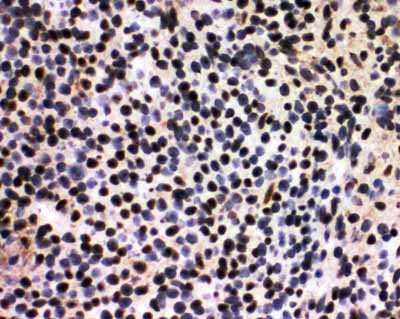 2 - Anti-splicing Factor 1 Antibody ABO11171