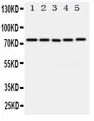 1 - Anti-ABCG1 Antibody ABO11175