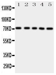 1 - Anti-BCRP/ABCG2 Antibody ABO11176