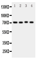 1 - Anti-BCRP/ABCG2 Antibody ABO11177