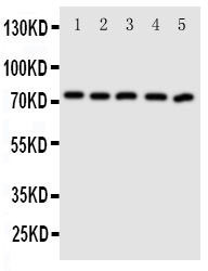 1 - Anti-ABCG5 Antibody ABO11178