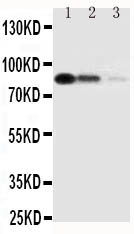 1 - Anti-CD163 Antibody ABO11180