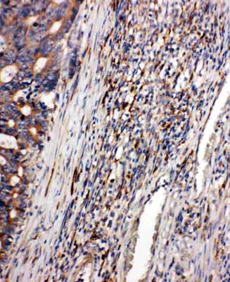 2 - Anti-CD163 Antibody ABO11181
