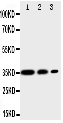 1 - Anti-CD163 Antibody ABO11181