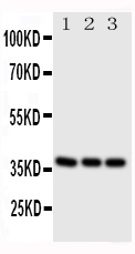 1 - Anti-CD1a Antibody ABO11182