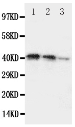 1 - Anti-DDR2 Antibody ABO11186